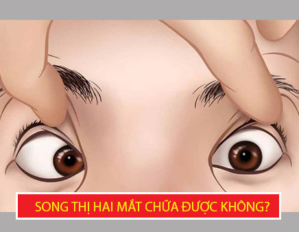 song-thi-hai-mat-co-chua-duoc-khong-nguyen-nhan-gay-song-thi-hai-mat-va-phuong-phap-dieu-tri.jpg